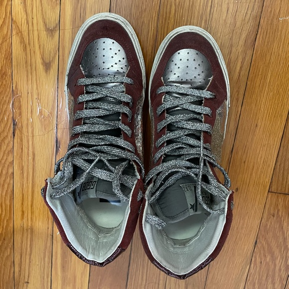 Golden goose zebra high tops - Picture 2 of 7